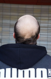 Street  724 bald hair head 0002.jpg